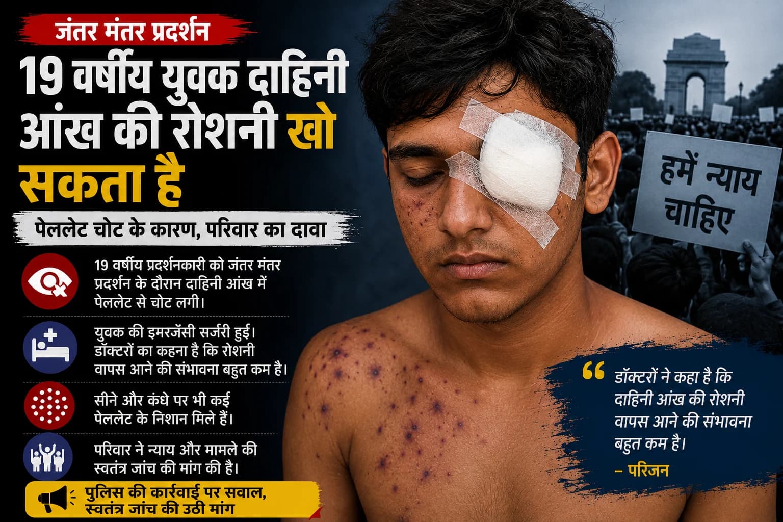 जंतर मंतर मार्च के दौरान पेलेट चोट के बाद 19 वर्षीय प्रदर्शनकारी की आंख की रोशनी जाने का खतरा, परिवार का दावा